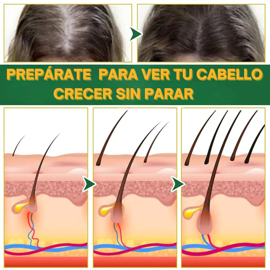 HairBoost Pro ¿Estás listo para transformar tu melena?